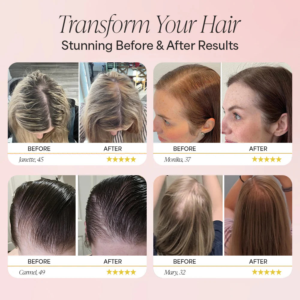 Relixa 4 in 1 Therapy Hair Brush